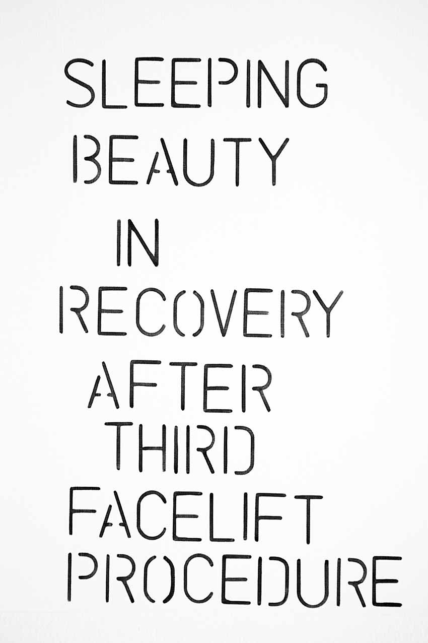 SLEEPING BEAUTY IN RECOVERY AFTER THIRD FACELIFT PROCEDURE